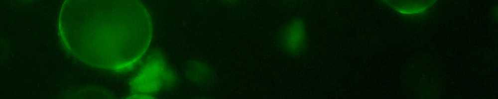 Polypeptide Multilayer Microcapsules