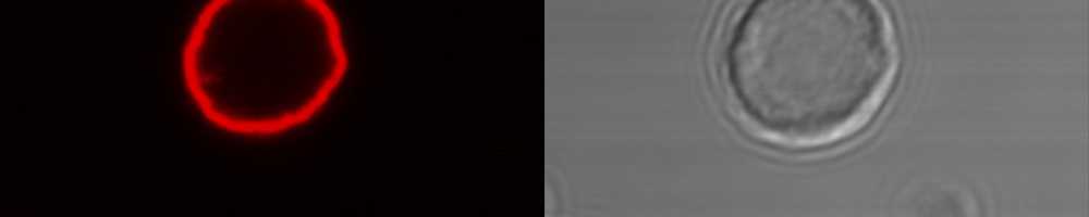 Polypeptide Multilayer Microcapsules